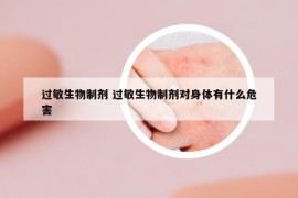 过敏生物制剂 过敏生物制剂对身体有什么危害