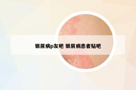银屑病p友吧 银屑病患者贴吧