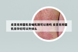 皮圣克抑菌乳膏哺乳期可以用吗 皮圣克抑菌乳膏孕妇可以外抹么