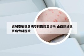 运城夏敏银屑病专科医院靠谱吗 山西运城银屑病专科医院