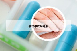 清理牛皮癣经验