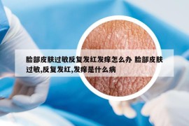 脸部皮肤过敏反复发红发痒怎么办 脸部皮肤过敏,反复发红,发痒是什么病