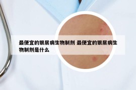 最便宜的银屑病生物制剂 最便宜的银屑病生物制剂是什么