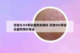 济南九六0军区医院皮肤科 济南960军区总医院预约电话