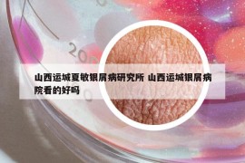 山西运城夏敏银屑病研究所 山西运城银屑病院看的好吗