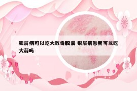 银屑病可以吃大败毒胶囊 银屑病患者可以吃大蒜吗