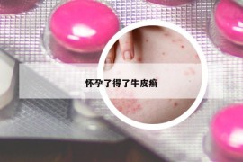 怀孕了得了牛皮癣