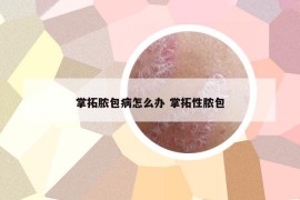 掌拓脓包病怎么办 掌拓性脓包