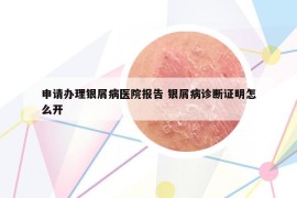 申请办理银屑病医院报告 银屑病诊断证明怎么开