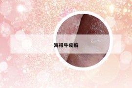 海报牛皮癣