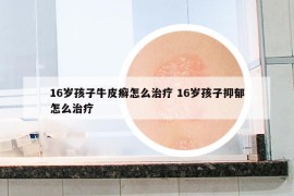 16岁孩子牛皮癣怎么治疗 16岁孩子抑郁怎么治疗