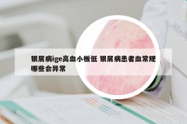 银屑病ige高血小板低 银屑病患者血常规哪些会异常