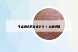牛皮癣志愿者计划书 牛皮癣标语