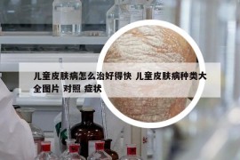 儿童皮肤病怎么治好得快 儿童皮肤病种类大全图片 对照 症状