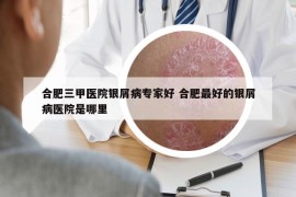 合肥三甲医院银屑病专家好 合肥最好的银屑病医院是哪里