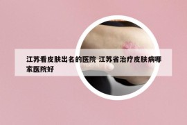 江苏看皮肤出名的医院 江苏省治疗皮肤病哪家医院好