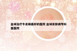 盐城治疗牛皮癣最好的医院 盐城皮肤病专科医医院