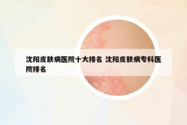 沈阳皮肤病医院十大排名 沈阳皮肤病专科医院排名