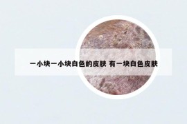 一小块一小块白色的皮肤 有一块白色皮肤