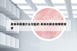 身体长藓是什么引起的 身体长藓会有哪些症状