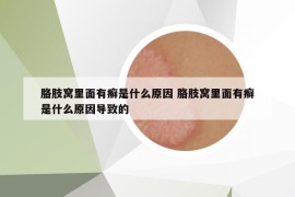 胳肢窝里面有癣是什么原因 胳肢窝里面有癣是什么原因导致的