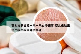 婴儿皮肤出现一块一块白咋回事 婴儿皮肤出现一块一块白咋回事儿
