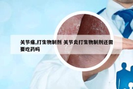 关节痛,打生物制剂 关节炎打生物制剂还需要吃药吗