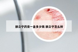 肤立宁药膏一盒多少钱 肤立宁怎么样