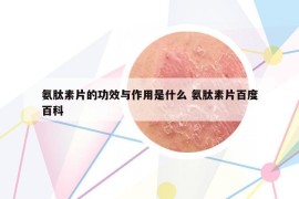 氨肽素片的功效与作用是什么 氨肽素片百度百科