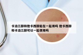 卡泊三醇和他卡西醇能在一起用吗 他卡西醇和卡泊三醇可以一起使用吗