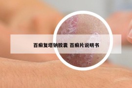 百癣复塔钠胶囊 百癣片说明书