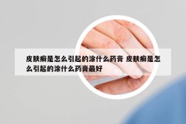 皮肤癣是怎么引起的涂什么药膏 皮肤癣是怎么引起的涂什么药膏最好