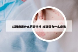 红斑癣用什么药膏治疗 红斑藓有什么症状