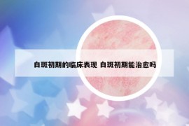 白斑初期的临床表现 白斑初期能治愈吗