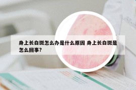 身上长白斑怎么办是什么原因 身上长白斑是怎么回事?