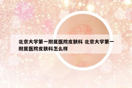 北京大学第一附属医院皮肤科 北京大学第一附属医院皮肤科怎么样