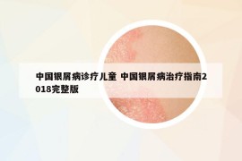 中国银屑病诊疗儿童 中国银屑病治疗指南2018完整版