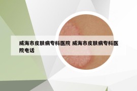 威海市皮肤病专科医院 威海市皮肤病专科医院电话