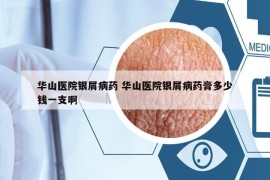 华山医院银屑病药 华山医院银屑病药膏多少钱一支啊