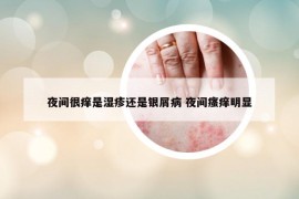 夜间很痒是湿疹还是银屑病 夜间瘙痒明显
