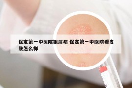 保定第一中医院银屑病 保定第一中医院看皮肤怎么样