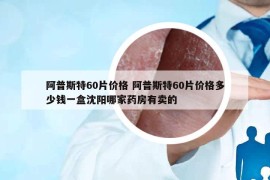 阿普斯特60片价格 阿普斯特60片价格多少钱一盒沈阳哪家药房有卖的