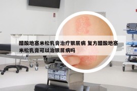 醋酸地塞米松乳膏治疗银屑病 复方醋酸地塞米松乳膏可以治银屑病吗