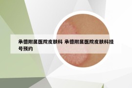 承德附属医院皮肤科 承德附属医院皮肤科挂号预约