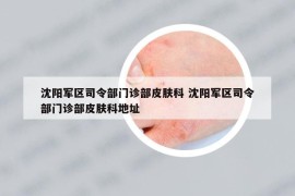 沈阳军区司令部门诊部皮肤科 沈阳军区司令部门诊部皮肤科地址