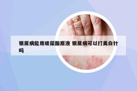 银屑病能用玻尿酸原液 银屑病可以打美白针吗