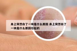 身上突然白了一块是什么原因 身上突然白了一块是什么原因引起的