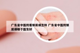 广东省中医院看银屑病怎样 广东省中医院银屑病哪个医生好