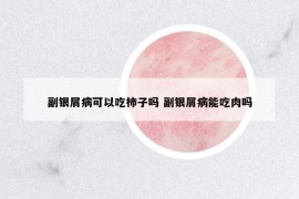 副银屑病可以吃柿子吗 副银屑病能吃肉吗