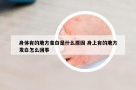 身体有的地方变白是什么原因 身上有的地方发白怎么回事